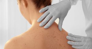 Primeros síntomas del cáncer de piel que debes conocer Primeros síntomas del cáncer de piel que debes conocer